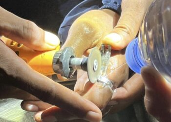 Cincin Sulit Dilepas Hingga Jari Bengkak, Pemuda di Kendari Minta Bantuan Damkar